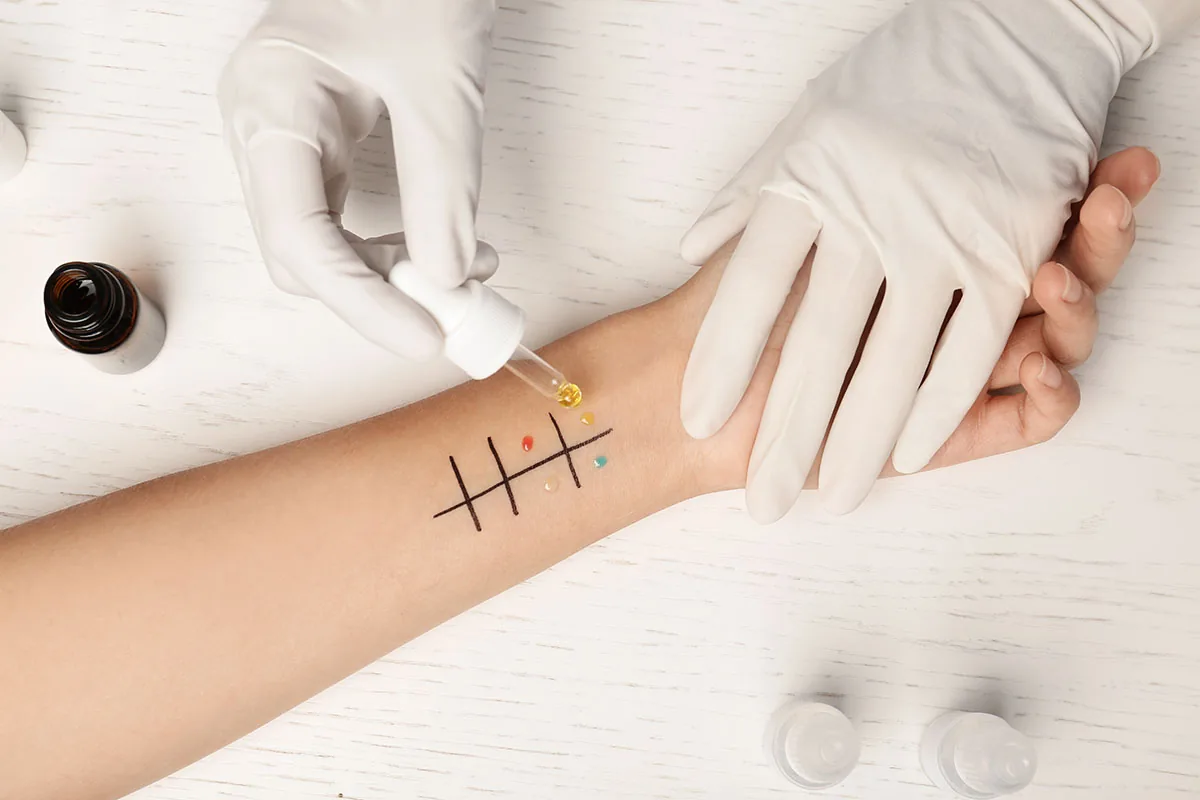 Dental Allergy Testing: Titanium Allergies – Titanium is Not Bio Inert