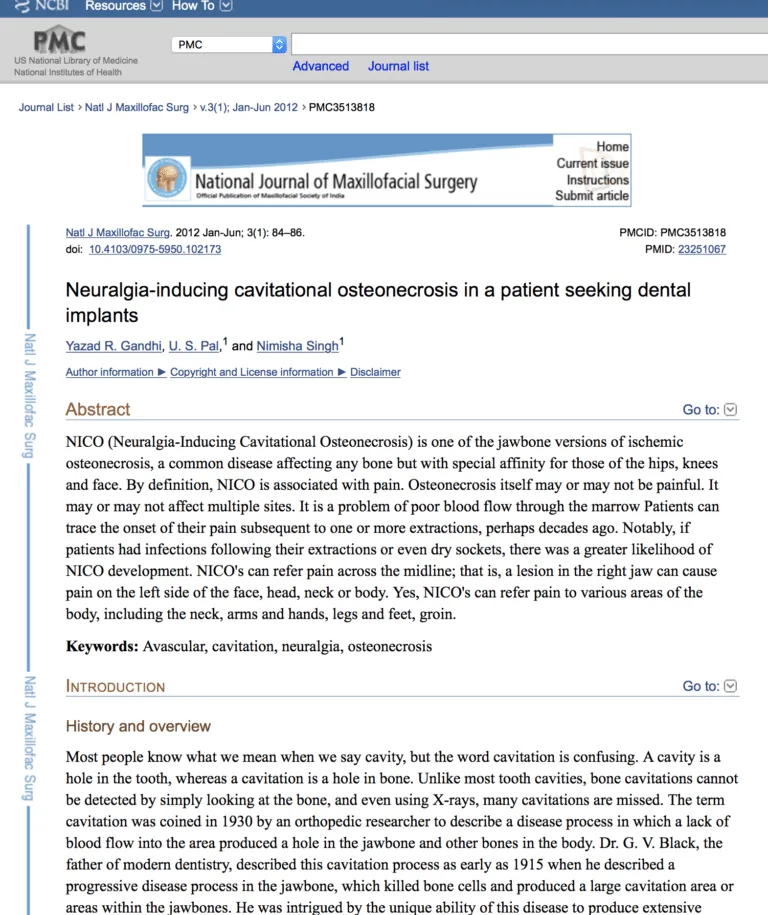 Dental Cavitations: pubmed1