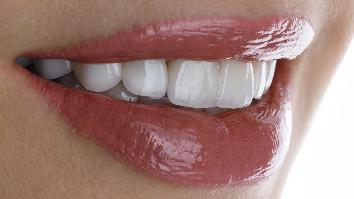 Natural Smile Design: natural smile