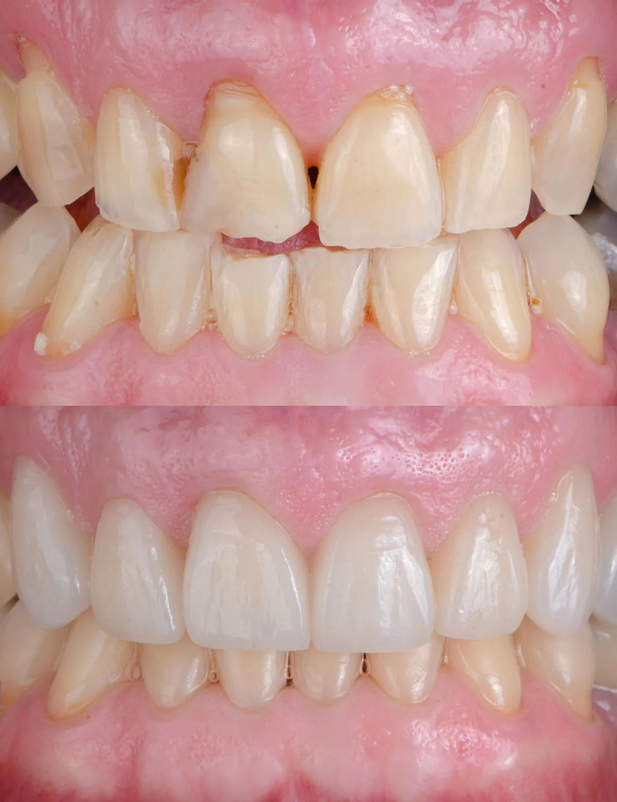 Natural Smile Design 1